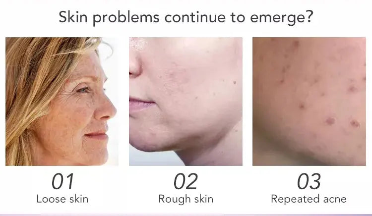 Women's facial skincare cream with collagen and whitening dark spot removal